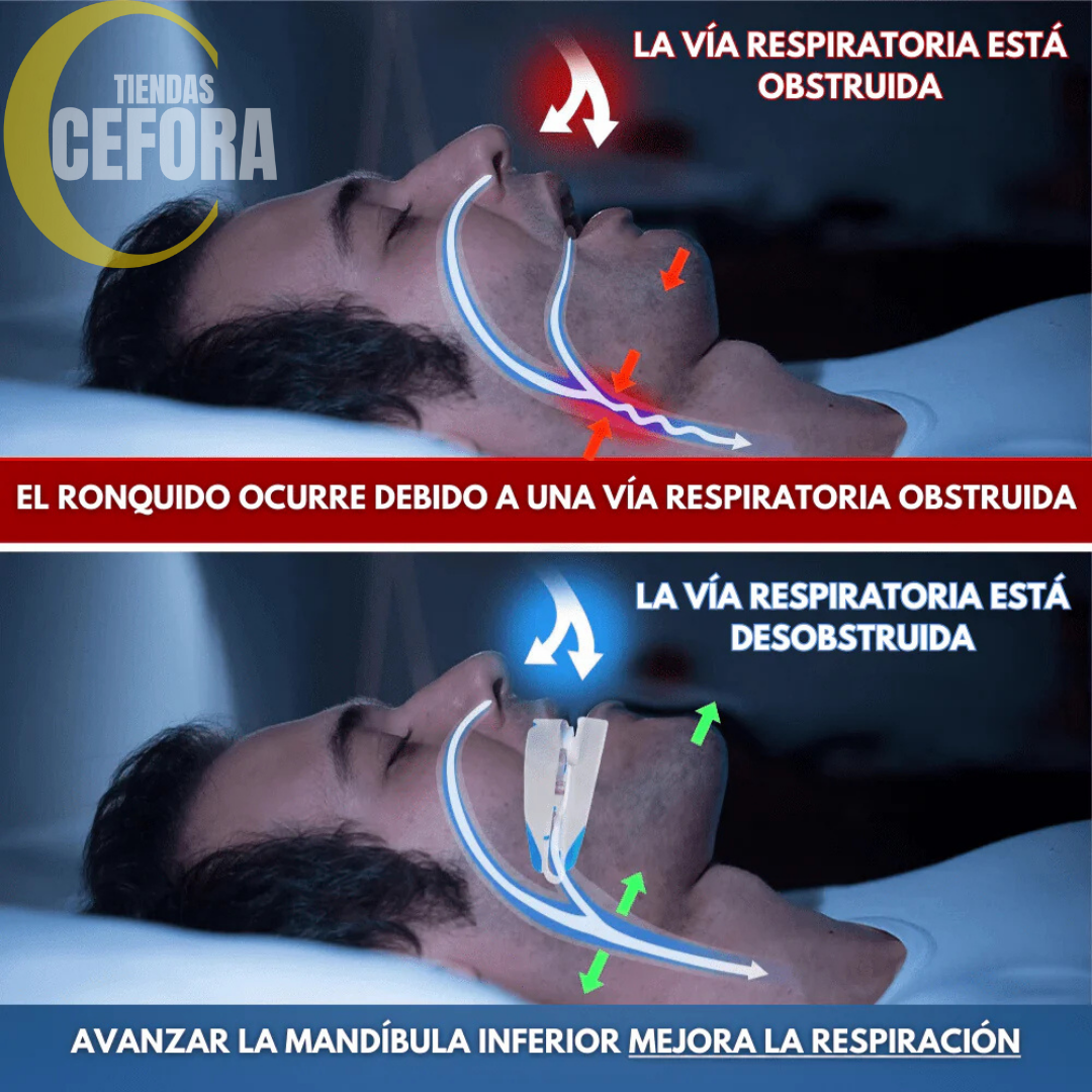 ZenSleep-Placa Anti Ronquido